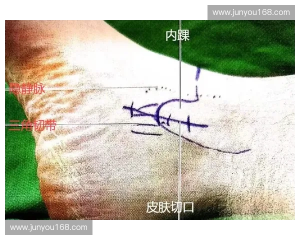 全面解析运动损伤预防策略与身体康复方法研究